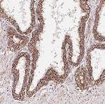 GBAS Antibody in Immunohistochemistry (Paraffin) (IHC (P))