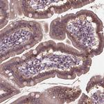 IRF6 Antibody in Immunohistochemistry (Paraffin) (IHC (P))
