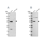 IRF6 Antibody in Western Blot (WB)