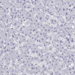 ARR3 Antibody in Immunohistochemistry (Paraffin) (IHC (P))