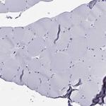 ARR3 Polyclonal Antibody