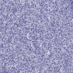ARR3 Antibody in Immunohistochemistry (Paraffin) (IHC (P))