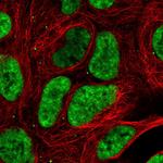 DDX17 Polyclonal Antibody