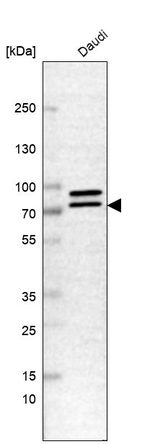 DDX17 Antibody in Western Blot (WB)