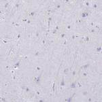 Granzyme K Antibody in Immunohistochemistry (Paraffin) (IHC (P))
