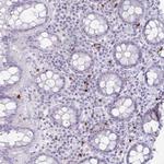 Granzyme K Antibody in Immunohistochemistry (Paraffin) (IHC (P))