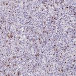 Granzyme K Antibody in Immunohistochemistry (Paraffin) (IHC (P))