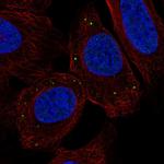 TMEM215 Polyclonal Antibody