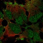 ZNF560 Polyclonal Antibody