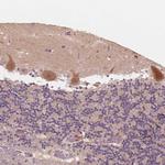 IL9R Antibody in Immunohistochemistry (Paraffin) (IHC (P))
