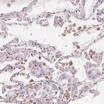 IL9R Antibody in Immunohistochemistry (Paraffin) (IHC (P))