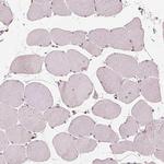 IL9R Polyclonal Antibody