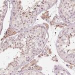 IL9R Antibody in Immunohistochemistry (Paraffin) (IHC (P))