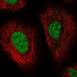 HSP40 Polyclonal Antibody