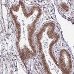 HSP40 Antibody in Immunohistochemistry (Paraffin) (IHC (P))