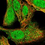 KPNA1 Polyclonal Antibody