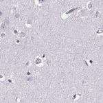 TCHHL1 Antibody in Immunohistochemistry (Paraffin) (IHC (P))
