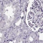 TCHHL1 Antibody in Immunohistochemistry (Paraffin) (IHC (P))