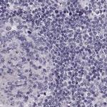TCHHL1 Antibody in Immunohistochemistry (Paraffin) (IHC (P))