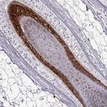 TCHHL1 Antibody in Immunohistochemistry (Paraffin) (IHC (P))