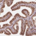 HMGN3 Antibody in Immunohistochemistry (Paraffin) (IHC (P))