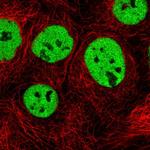 SFRS10 Polyclonal Antibody