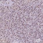 SFRS10 Antibody in Immunohistochemistry (Paraffin) (IHC (P))