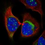 ZNF404 Polyclonal Antibody