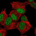 ZNF358 Polyclonal Antibody