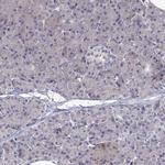 SULT2A1 Polyclonal Antibody