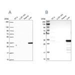 SULT2A1 Antibody in Western Blot (WB)