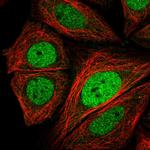 CRTC3 Polyclonal Antibody