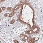 MAPKAPK2 Polyclonal Antibody