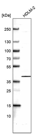 IkB beta Antibody in Western Blot (WB)