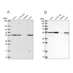 PMPCA Antibody in Western Blot (WB)