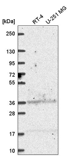 ALDH3A1 Antibody in Western Blot (WB)
