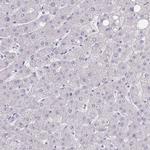 SEPT5 Polyclonal Antibody