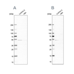 SPTLC1 Antibody in Western Blot (WB)