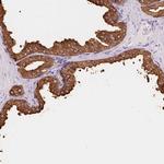 Prostate Specific Acid Phosphatase Antibody in Immunohistochemistry (Paraffin) (IHC (P))
