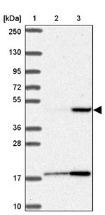 Prostate Specific Acid Phosphatase Antibody in Western Blot (WB)