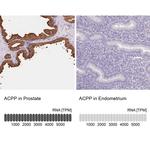 Prostate Specific Acid Phosphatase Antibody