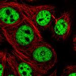 UBE4A Polyclonal Antibody