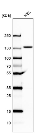 UBE4A Antibody in Western Blot (WB)
