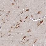 TM9SF4 Antibody in Immunohistochemistry (Paraffin) (IHC (P))