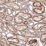 TM9SF4 Antibody in Immunohistochemistry (Paraffin) (IHC (P))