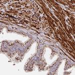 TM9SF4 Antibody in Immunohistochemistry (Paraffin) (IHC (P))