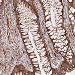 TM9SF4 Antibody in Immunohistochemistry (Paraffin) (IHC (P))
