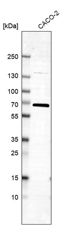 TM9SF4 Antibody in Western Blot (WB)