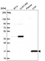 CDA Antibody in Western Blot (WB)