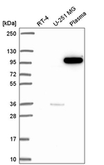 PIK3CB Antibody in Western Blot (WB)